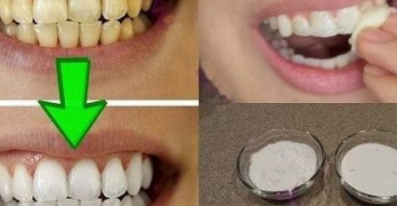 PROVJERENO DJELUJE: Evo kako da zagarantovano izbijelite zube za manje od 2 minuta!
