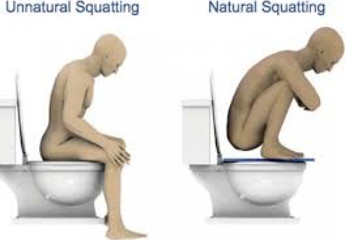 BUDITE OPREZNI! Nepravilan položaj na WC šolji može da izazove RAK debelog crijeva! OVO JE PRAVILNO!