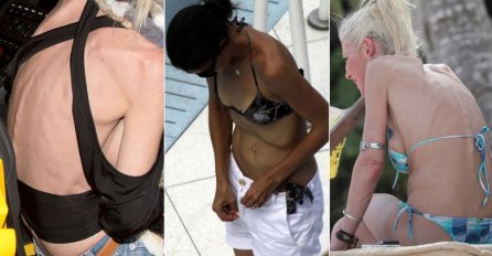 IZGLEDAJU KAO KOST I KOŽA: Fotografije slavnih ljepotica zbog kojih je svijet ZANIJEMIO  