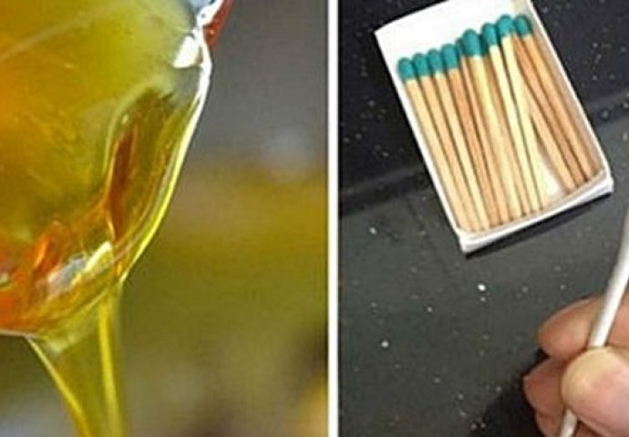 JEDETE LI LAŽNI MED: Otkrijte to ovim jednostavnim trikom sa ŠIBICOM 