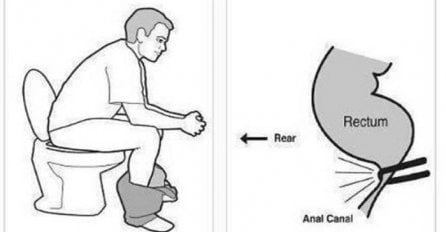 Da li ste od onih koji cijelog svog života sjede pogrešno na WC šolji?