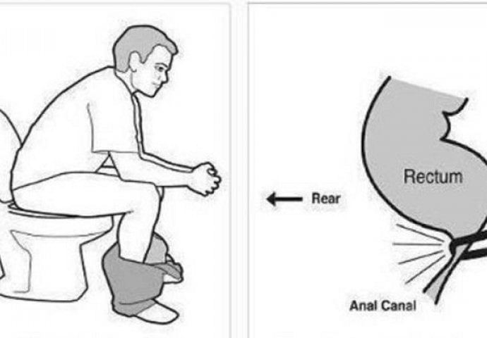 Da li ste od onih koji cijelog svog života sjede pogrešno na WC šolji?