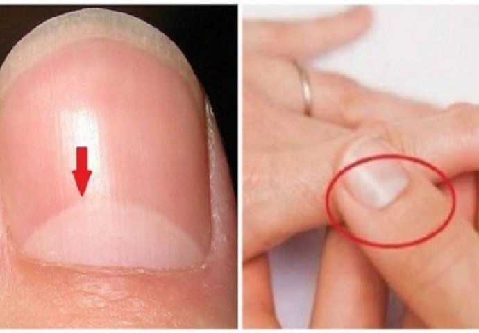 Da li znate šta oblik POLUMJESECA na vašim noktima znači? Odgovor je važniji nego što mislite!
