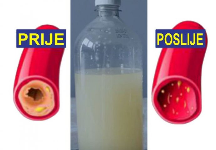 MOĆNI RECEPT: Samo jedna čaša ovog soka očisti vaše arterije i pomaže SRCU I TIJELU DA RADE BOLJE!