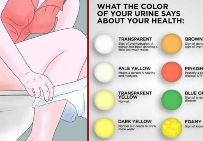 DOVOLJAN JE SAMO JEDAN POGLED U WC ŠOLJU: Evo šta boja urina otkriva o vašem zdravlju, ODMAH DOKTORU AKO JE OVE BOJE!