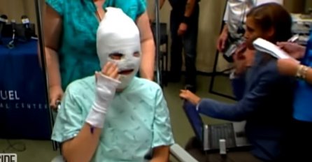 PRIJAVILA JE NAPAD KISELINOM: Žena je završila je sa opasnim opekotinama, ali je tek u bolnici otkrivena jeziva istina (VIDEO)