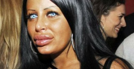 TRANSFORMACIJA VIJEKA! Svi su se zgražavali nad njom, a DANAS JOJ PORUČUJU DA JE “PRELIJEPA”!