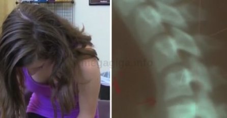 Djevojčica je osjećala jake bolove u vratu, a roditelji su ostali UŽASNUTI nakon što su doktori dijagnosticirali OVO (VIDEO)