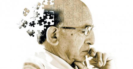 PRIJE POJAVE SIMPTOMA: Naučnici razvili test koji otkriva rane znakove Alzheimera!