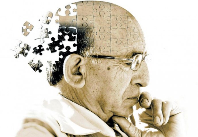 PRIJE POJAVE SIMPTOMA: Naučnici razvili test koji otkriva rane znakove Alzheimera!