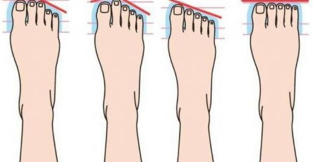 Oblik stopala otkriva ličnost do gole kože: Pogledajte svoje noge i sve će vam biti jasno 