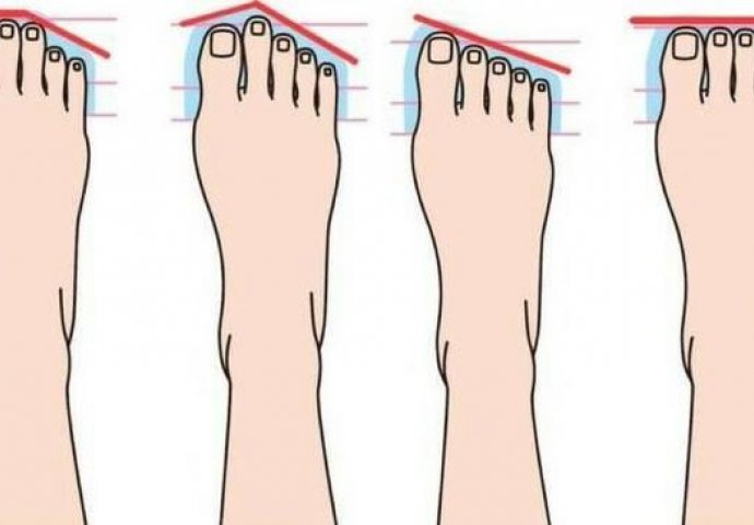Oblik stopala otkriva ličnost do gole kože: Pogledajte svoje noge i sve će vam biti jasno 