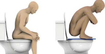 UPOZORENJE: Nepravilno sjedenje na WC šolji može da izazove rak debelog crijeva! EVO KAKO JE ISPRAVNO! (VIDEO)