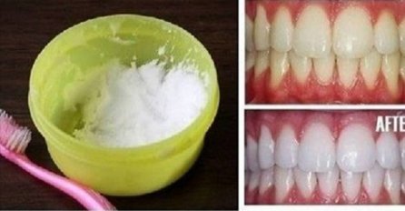 POTPUNO PRIRODNO: Koristeći ovaj trik, dobit ćete bijele zube za samo 3 minute!
