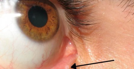  Sigurno nikad niste primijetili OVU BIZARNU STVAR na svom donjem kapku: Evo koja je njena SVRHA