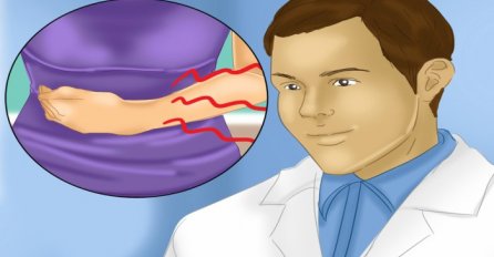 UČESTALO MOKRENJE, BOL I PECKANJE TAMO DOLE? Treba vam samo jedna namirnica da izliječite URINARNE INFEKCIJE, OVO ĆE VAS SPASITI!