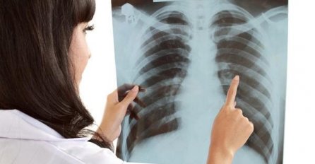 Bolja dijagnostika, liječenje i životni standard rezultirali padom učestalosti tuberkuloze u FBiH