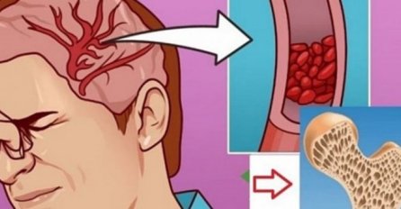 5 ZNAKOVA DA VAŠEM ORGANIZMU NEDOSTAJE MAGNEZIJ: Ako uočite ove simptome odmah reagujte, bez magnezija naš organizam ne može pravilno funkcionirati