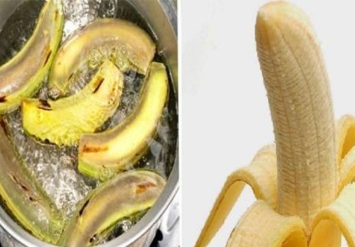  Kada vidite za šta sve možete iskoristiti koru od banane, bit će vam žao što ranije niste otkrili ove GENIJALNE trikove! 