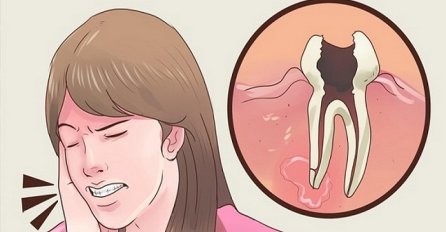 Najbrži lijek za zubobolju: BOL PRESTAJE U TRENU!