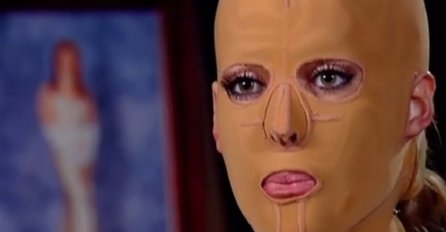 LJUBOMORNA ŽENA JE ŽIVU SPALILA: Nosila masku 3 godine, imala 200 operacija, a danas izgleda OVAKO!