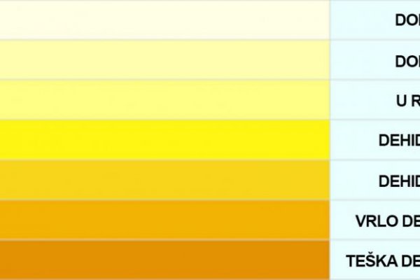 Молоко желто зеленого цвета. Ярко желтая моча. Шкала цвета мочи. Насыщенно желтый цвет мочи.