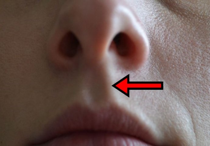 NAUČNICI KONAČNO OTKRILI: Evo zašto svi imamo udubljenje između nosa i gornje usne (VIDEO)