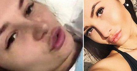 STRAVA! POKUŠAO DA JE SILUJE I UBIJE: Djevojka slomila kičmu kad je skočila sa 6. sprata da bi se spasila