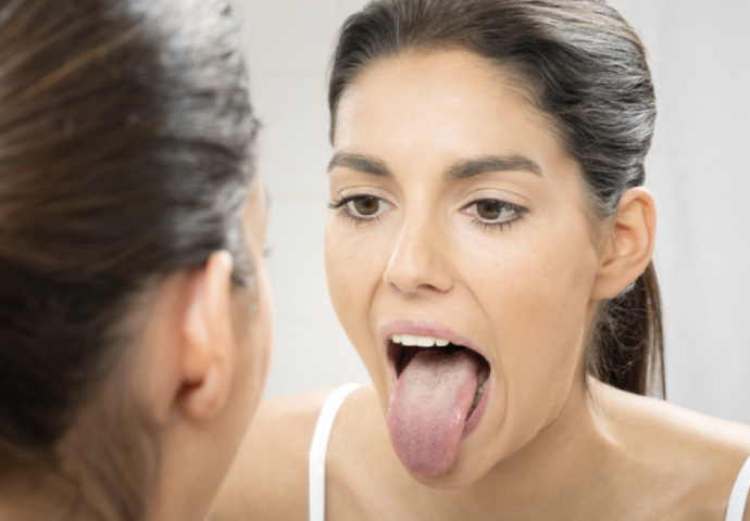PRVI ZNAK TEŠKOG OBOLJENJA: Ukoliko primijetite OVO na jeziku odmah idite doktoru!