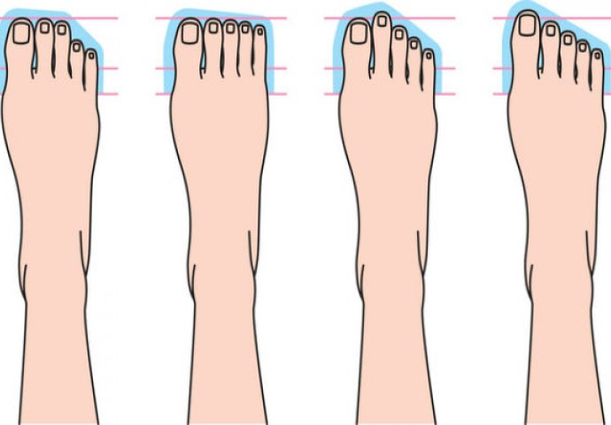 Dobro pogledajte svoje prste na nogama: Ako vam je drugi prst duži od svih ostalih, onda biste morali da znate OVO o svom zdravlju