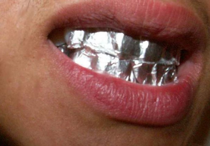 KORISTAN SAVJET: Znate li šta se dešava ako aluminijsku foliju držite na zubima 1 sat?