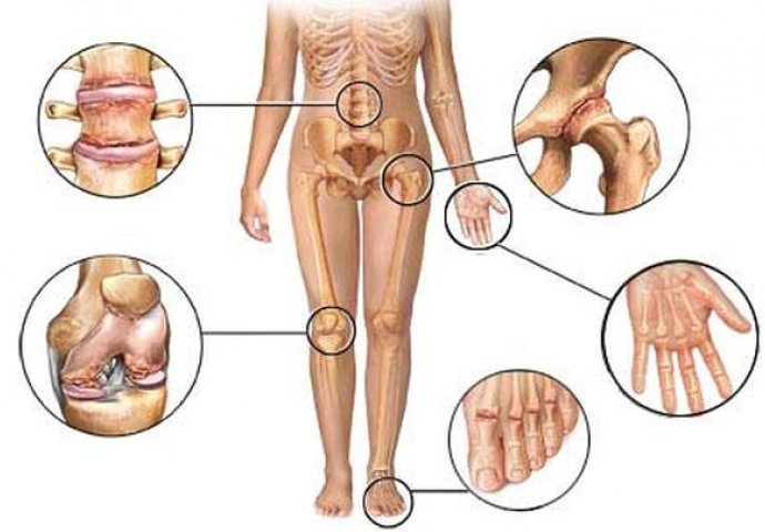 bol u zglobovima laktovima koljena