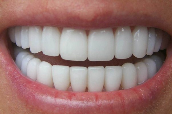 zubi-osmjeh