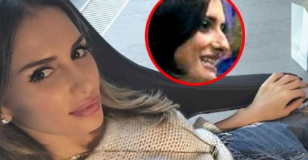 PRIJE PLASTIČNOG HIRURGA BI VAS UPLAŠILE NA ULICI: Pogledajte naše zvijezde prije PLASTIČNIH KOREKCIJA 