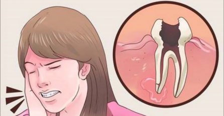 LIJEK KOJI SVI IMATE U KUHINJI: Zubobolja će nestati za minutu ako znate ovaj TRIK!