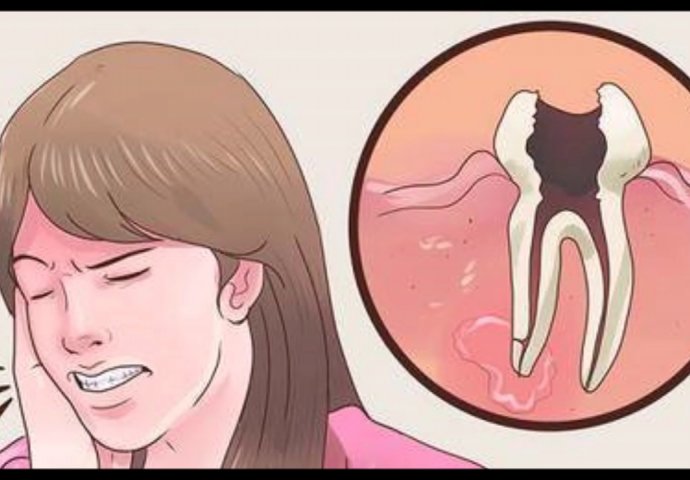 LIJEK KOJI SVI IMATE U KUHINJI: Zubobolja će nestati za minutu ako znate ovaj TRIK!