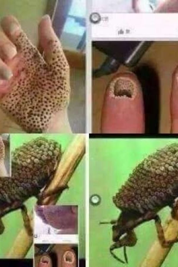 935095-buba-insekt-infejcija-po-s