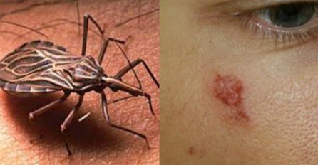 OVOG INSEKTA ZOVU BUBA UBICA: Ako vidite jednog u svojoj kući, odmah zovite pomoć, POSLJEDICE SU FATALNE!