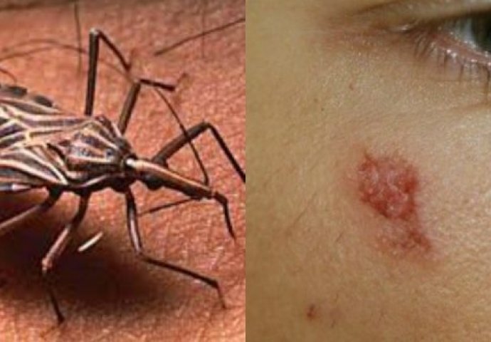 OVOG INSEKTA ZOVU BUBA UBICA: Ako vidite jednog u svojoj kući, odmah zovite pomoć, POSLJEDICE SU FATALNE!