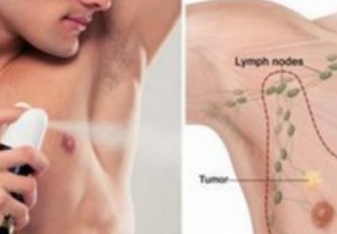 RAK DOJKE KOD MUŠKARACA: I oni isto mogu oboljeti, a javljaju se ljekaru u KASNOJ FAZI, simptome prepoznajte NA VRIJEME!