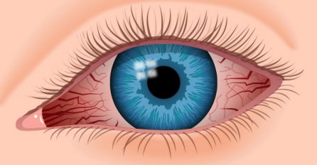  7 upozoravajućih simptoma koje možete vidjeti na očima, dovoljan je samo pogled u ogledalo