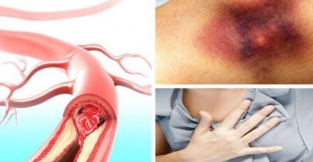 RECEPT KOJI MORATE ZNATI: Ovaj jednostavni lijek sprječava srčani i moždani udar!