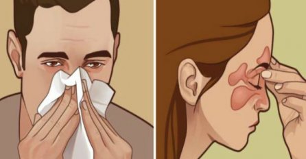 Ima li što gore od začepljenog nosa: Evo osam načina kako odčepiti nos i ponovo duboko udahnuti