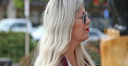 POZNATA GLUMICA VIŠE NE LIČI NA SEBE: Nervni slom je ostavio OZBILJNE posljedice na njenom licu, to više nije ona