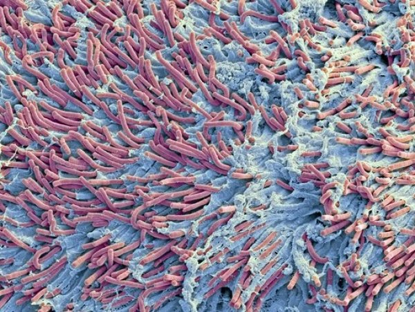 promene-boja-na-slikama-mogu-pokazati-razlicite-karakteristike-ovih-bakterija-9