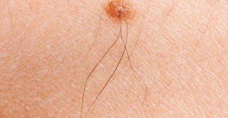 DA LI SMIJETE ČUPATI DLAČICE IZ MLADEŽA: Zašto su one IZRAZITO CRNE, ovo je istina!