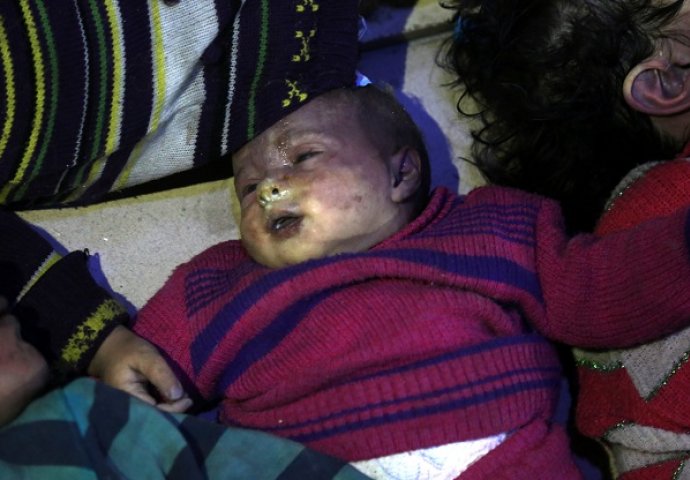 HOROR! Uznemirujuće fotografije, ali važno je znati kako stvarno izgleda užas u Siriji