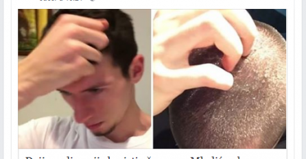 Mladić nije koristio šampon dvije godine: Pokazao kako mu je kosa izgledala prije i kako izgleda danas