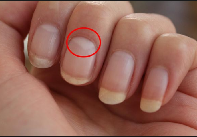 Evo na šta ukazuje bijeli polukrug na vašem noktu: OBRATITE PAŽNJU NA JASNE ZNAKOVE