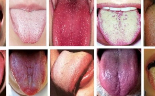 header-tongue-health-e1435088362856